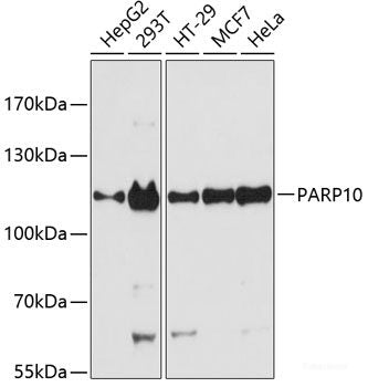 Western blot analysis of extracts of various cell lines using ACOT8 Polyclonal Antibody at dilution of 1:3000.