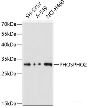 Western blot analysis of extracts of Mouse brain using PRMT3 Polyclonal Antibody at dilution of 1:3000.