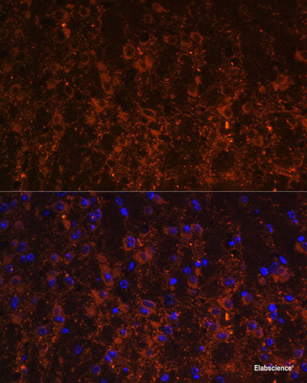 Western blot analysis of extracts from normal (control) and IFITM3 knockout (KO) HeLa cells using IFITM3 Polyclonal Antibody at dilution of 1:3000.