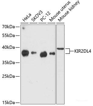 Western blot analysis of extracts of various cell lines using GCN1L1 Polyclonal Antibody at dilution of 1:3000.