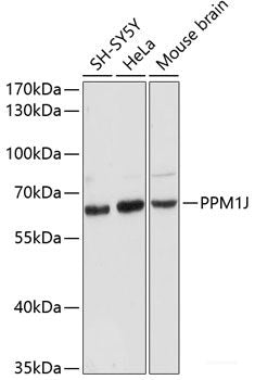 Western blot analysis of extracts of Mouse liver using RPRD2 Polyclonal Antibody at dilution of 1:3000.