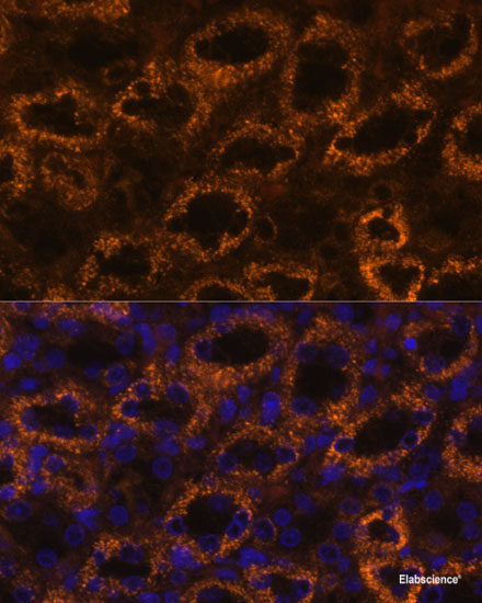 Western blot analysis of extracts of various cell lines using VPS39 Polyclonal Antibody at dilution of 1:3000.
