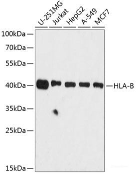 Western blot analysis of extracts of Rat brain using c-Myc Polyclonal Antibody at dilution of 1:500.