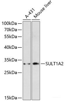 Western blot analysis of extracts of various cell lines using AADAT Polyclonal Antibody at dilution of 1:3000.