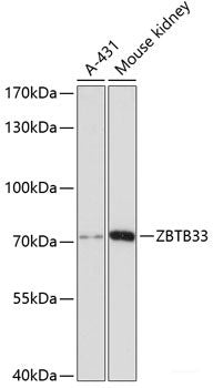 Western blot analysis of extracts of various cell lines using PPME1 Polyclonal Antibody at dilution of 1:3000.