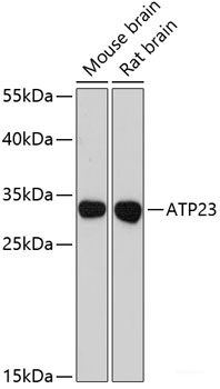 Immunohistochemistry of paraffin-embedded Rat retina using ANO2 Polyclonal Antibody at dilution of 1:200 (40x lens).