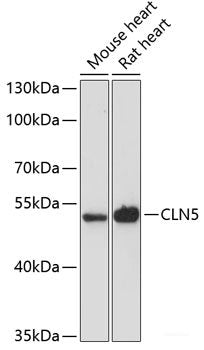 Western blot analysis of extracts of various cell lines using LRRC7 Polyclonal Antibody at dilution of 1:3000.