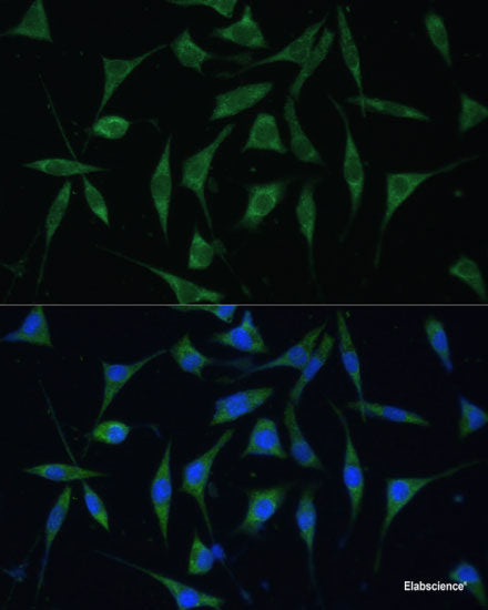 Western blot analysis of extracts of various cell lines using CWC22 Polyclonal Antibody at dilution of 1:3000.