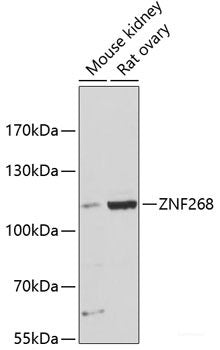 Western blot analysis of extracts of various cell lines using MTMR9 Polyclonal Antibody at dilution of 1:3000.