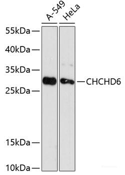 Western blot analysis of extracts of various cell lines using TSLP Polyclonal Antibody at dilution of 1:3000.