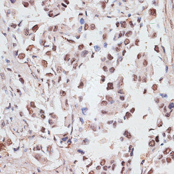 Immunofluorescence analysis of C6 cells using SCGB3A2 Polyclonal Antibody at dilution of 1:100. Blue: DAPI for nuclear staining.