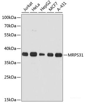 Western blot analysis of extracts of various cell lines using FMN1 Polyclonal Antibody at dilution of 1:3000.