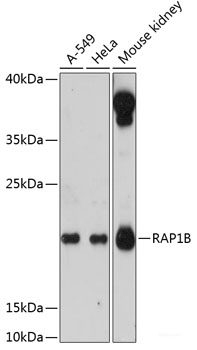 Western blot analysis of extracts of Mouse heart using DNASE1L1 Polyclonal Antibody at dilution of 1:3000.
