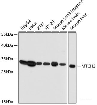 Immunohistochemistry of paraffin-embedded Rat pancreas using ZNF581 Polyclonal Antibody at dilution of 1:100 (40x lens).