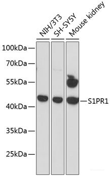 Immunohistochemistry of paraffin-embedded Human lung cancer using U2AF1 Polyclonal Antibody at dilution of 1:100 (40x lens).