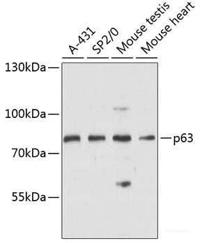 Western blot analysis of extracts of Mouse liver using PER2 Polyclonal Antibody at dilution of 1:3000.