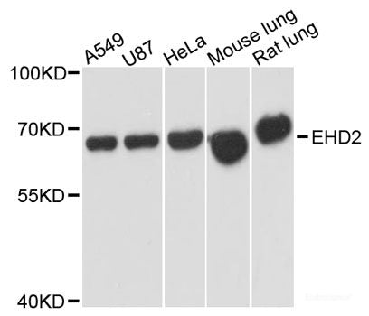 Western blot analysis of extracts of various cell lines using KLF10 Polyclonal Antibody at dilution of 1:3000.