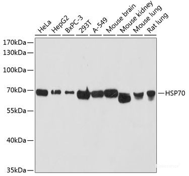Western blot analysis of extracts of various cell lines using ZC3H7A Polyclonal Antibody at dilution of 1:3000.