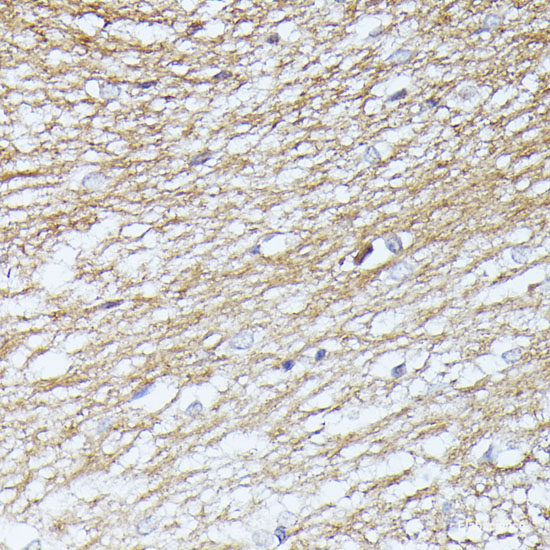 Western blot analysis of extracts of various cell lines using CRISPLD2 Polyclonal Antibody at dilution of 1:3000.