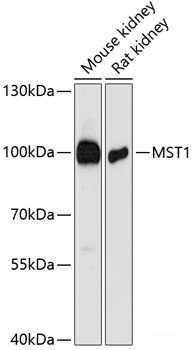 Western blot analysis of extracts of various cell lines using MRPL45 Polyclonal Antibody at dilution of 1:1000.