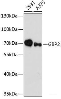 Western blot analysis of extracts of Rat lung using SLC29A1 Polyclonal Antibody at dilution of 1:3000.