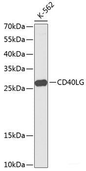 Western blot analysis of extracts of various cell lines using SIAE Polyclonal Antibody at dilution of 1:3000.