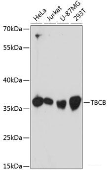Western blot analysis of extracts of various cell lines using SREK1 Polyclonal Antibody at dilution of 1:3000.