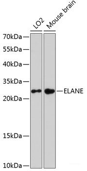 Western blot analysis of extracts of various cell lines using GPIHBP1 Polyclonal Antibody at dilution of 1:3000.