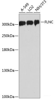 Western blot analysis of extracts of Rat serum using CFB Polyclonal Antibody at dilution of 1:3000.