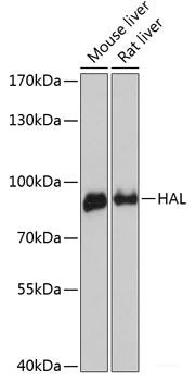 Immunofluorescence analysis of NIH/3T3 cells using CHAT Polyclonal Antibody at dilution of 1:100. Blue: DAPI for nuclear staining.
