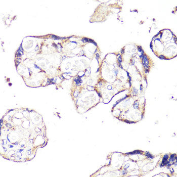 Immunofluorescence analysis of C6 cells using IDH1 Polyclonal Antibody at dilution of 1:100 (40x lens). Blue: DAPI for nuclear staining.