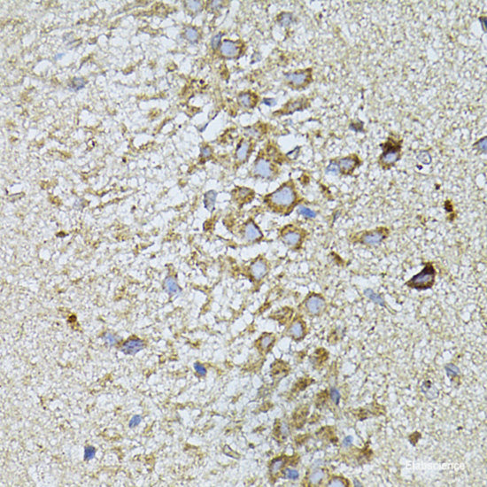 Immunohistochemistry of paraffin-embedded Rat brain using TBCB Polyclonal Antibody at dilution of 1:100 (40x lens).