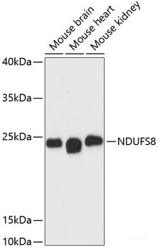 Immunofluorescence analysis of MCF7 cells using LRat Polyclonal Antibody