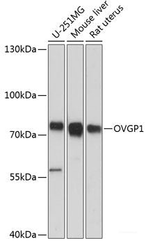 Immunofluorescence analysis of A549 cells using KAT5 Polyclonal Antibody