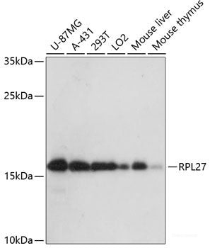 Immunohistochemistry of paraffin-embedded Human colon using HHLA2 Polyclonal Antibody at dilution of 1:100 (40x lens).
