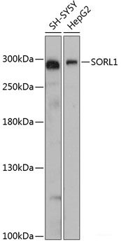 Western blot analysis of extracts of Mouse brain using YOD1 Polyclonal Antibody at dilution of 1:3000.