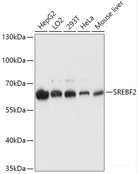 Immunohistochemistry of paraffin-embedded Rat liver using CTCF Polyclonal Antibody at dilution of 1:200 (40x lens).