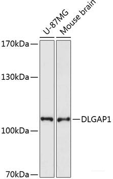 Immunofluorescence analysis of U2OS cells using Cyclin D2 Polyclonal Antibody