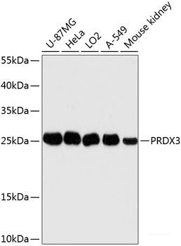 Immunohistochemistry of paraffin-embedded Rat lung using DDX5 Polyclonal Antibody at dilution of 1:100 (40x lens).