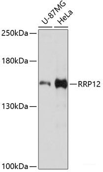 Immunohistochemistry of paraffin-embedded Human liver damage using DLST Polyclonal Antibody at dilution of 1:100 (40x lens).