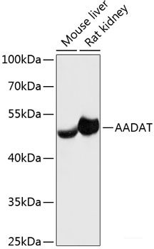 Western blot analysis of extracts of Rat lung using FLT4 Polyclonal Antibody at dilution of 1:1000.
