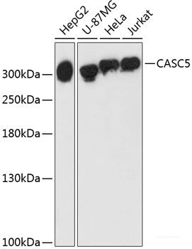 Western blot analysis of extracts of Mouse liver using LRP6 Polyclonal Antibody at dilution of 1:1000.
