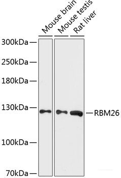 Western blot analysis of extracts of various cell lines using MYBPC2 Polyclonal Antibody at dilution of 1:1000.