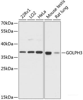Immunohistochemistry of paraffin-embedded Rat spleen using PCNA Polyclonal Antibody at dilution of 1:100 (40x lens).