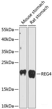 Immunofluorescence analysis of U2OS cells using MAPK3 Polyclonal Antibody