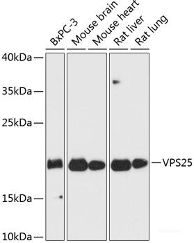 Western blot analysis of extracts of various cell lines using PSMC3 Polyclonal Antibody at dilution of 1:1000.