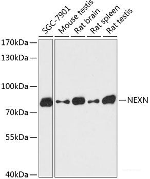Immunofluorescence analysis of MCF-7 cells using RANGAP1 Polyclonal Antibody