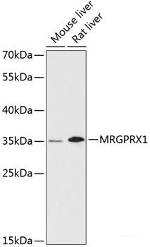 Immunofluorescence analysis of U2OS cells using SGCD Polyclonal Antibody