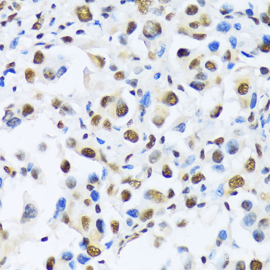 Immunofluorescence analysis of HeLa cells using RIPK2 Polyclonal Antibody