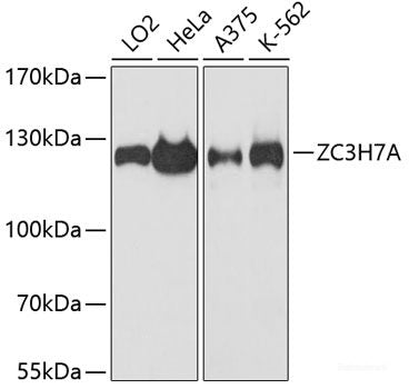 Immunohistochemistry of paraffin-embedded Mouse brain using TNFRSF11A Polyclonal Antibody at dilution of 1:100 (20x lens).